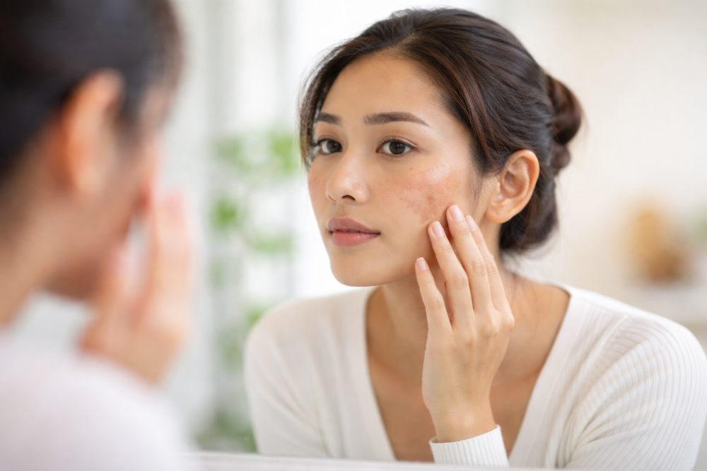 Kenali Gangguan Pigmentasi Kulit: Penyebab, Jenis, hingga Cara Penanganannya